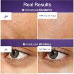 اسنس لیفتینگ نامبوزین - Image 3