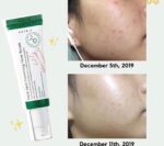 سرم ضد لک اکسیس وای - Image 4